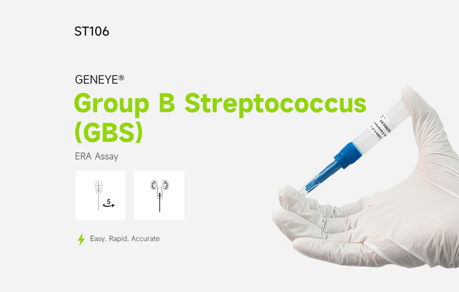GENEYE® GBS ERA Assay